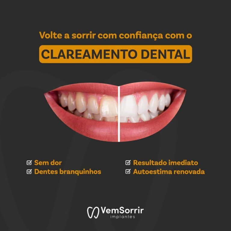 Clareamento dental